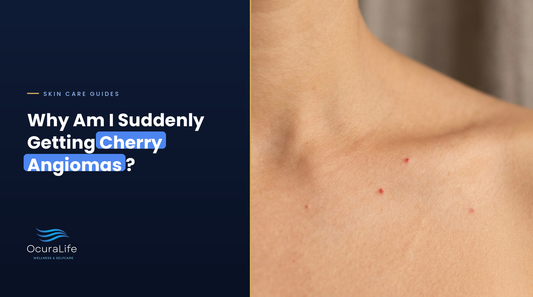 Why Am I Suddenly Getting Cherry Angiomas?