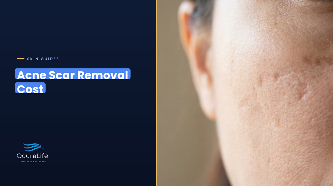 Acne scar removal cost: close-up of shallow boxcar and rolling acne scars on a cheek