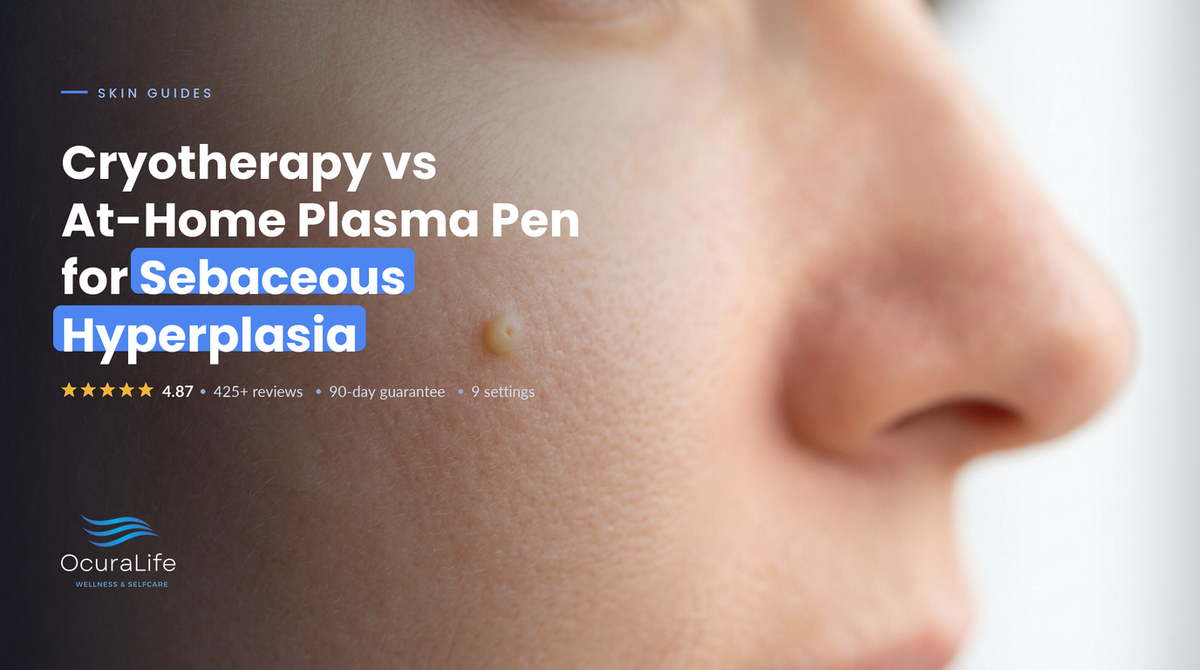 Cryotherapy vs At-Home Plasma Pen for Sebaceous Hyperplasia