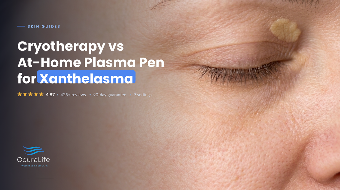 Cryotherapy vs At-Home Plasma Pen for Xanthelasma
