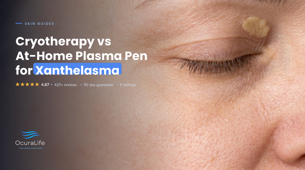 Cryotherapy vs At-Home Plasma Pen for Xanthelasma