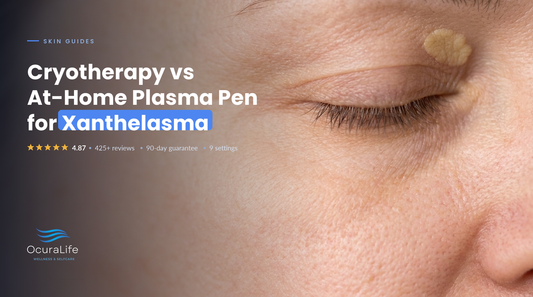 Cryotherapy vs At-Home Plasma Pen for Xanthelasma
