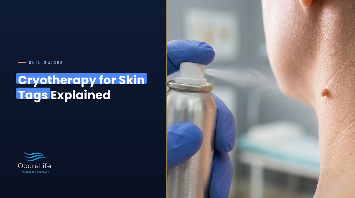Gloved hand spraying a cryotherapy canister at a small skin tag on the side of the neck