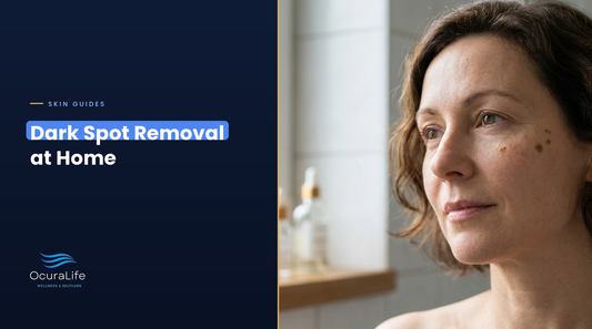 Dark spot removal at home: flat brown dark spots on a woman's cheek