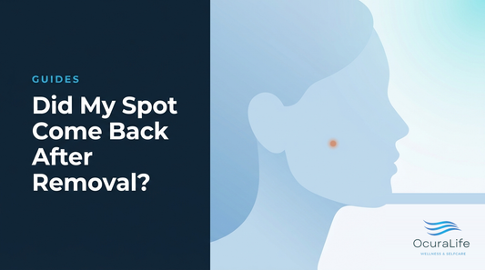 Did My Spot Come Back After Removal?