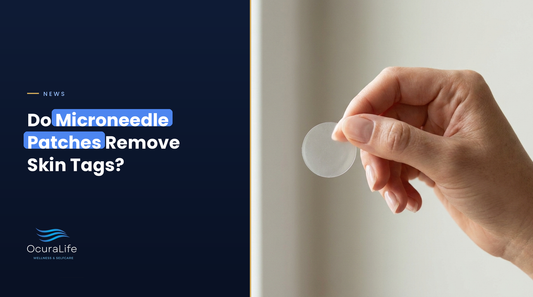 Do Microneedle Patches Remove Skin Tags? What They Can and Cannot Do