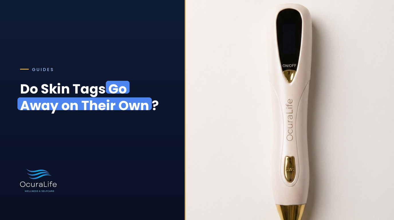 Do Skin Tags Go Away on Their Own?