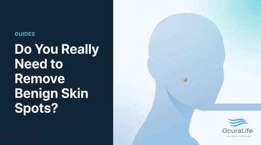 Do You Really Need to Remove Benign Skin Spots?