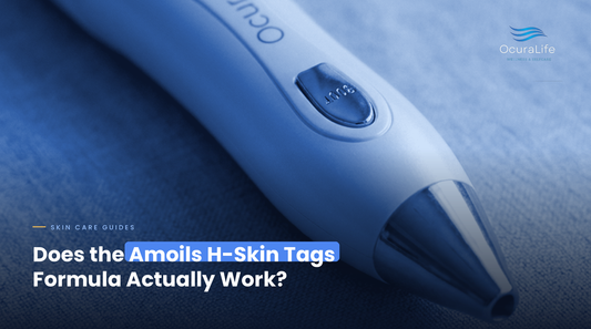 Does the Amoils H-Skin Tags Formula Actually Work?