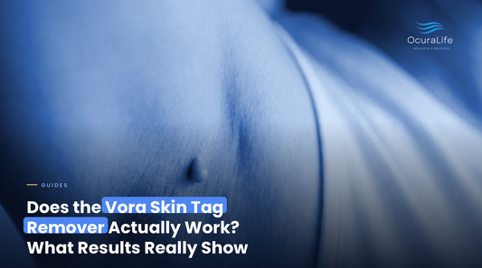 Does the Vora Skin Tag Remover Actually Work? What Results Really Show