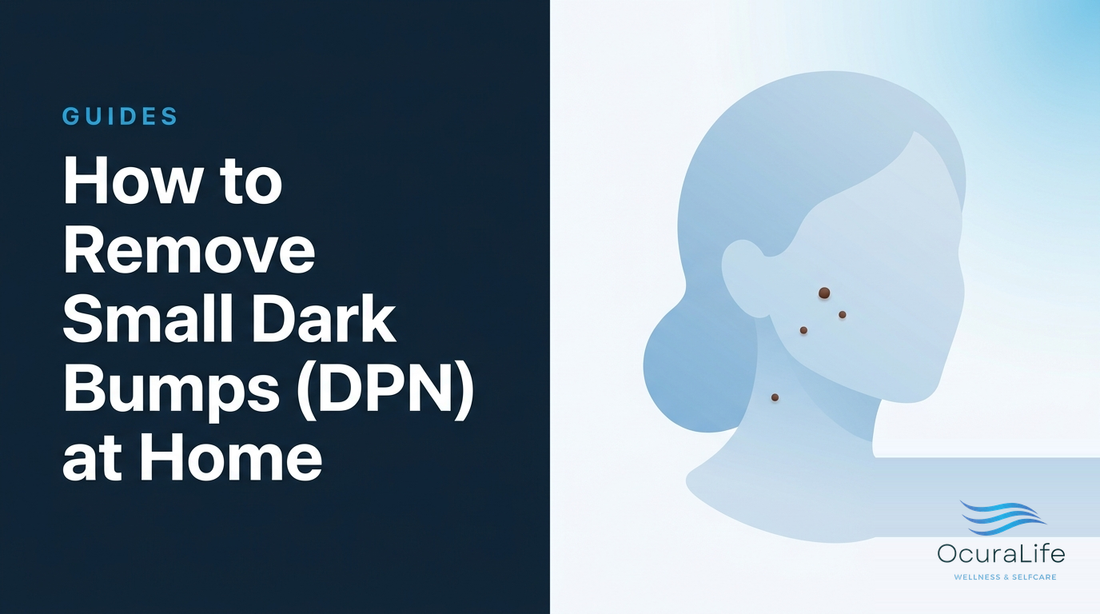 How to Remove Small Dark Bumps (DPN) at Home - OcuraLife