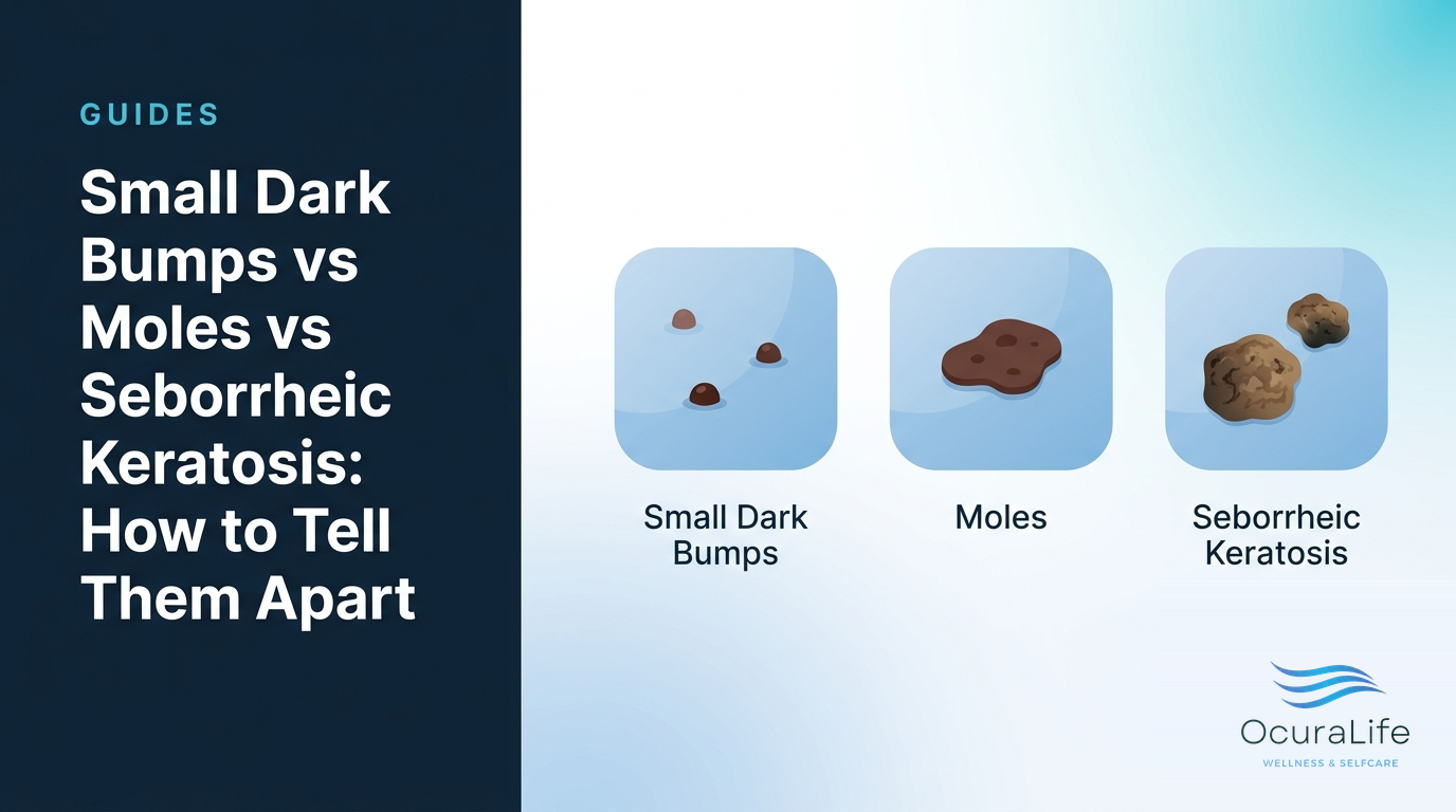 Small Dark Bumps vs Moles vs Seborrheic Keratosis: How to Tell Them Apart - OcuraLife