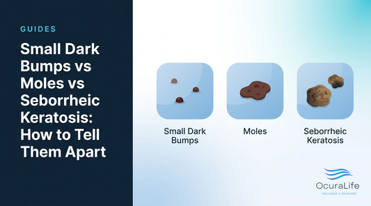 Small Dark Bumps vs Moles vs Seborrheic Keratosis: How to Tell Them Apart - OcuraLife