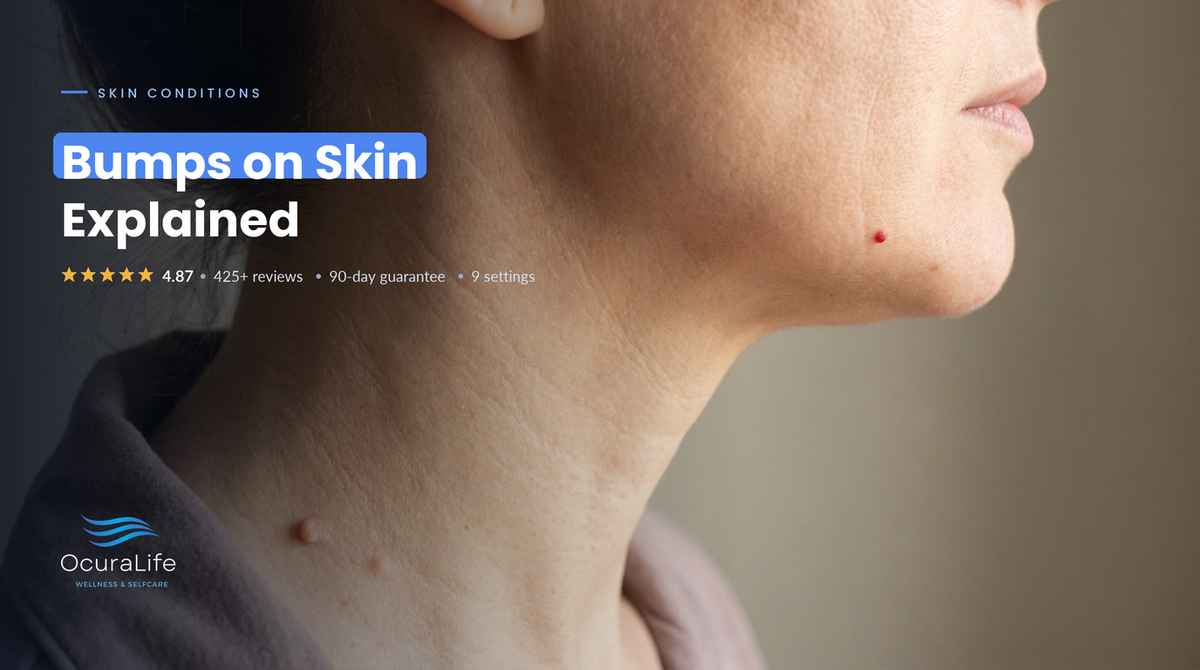 Close-up of a small skin tag on the neck and a tiny red cherry angioma on the jaw, two common harmless bumps on skin