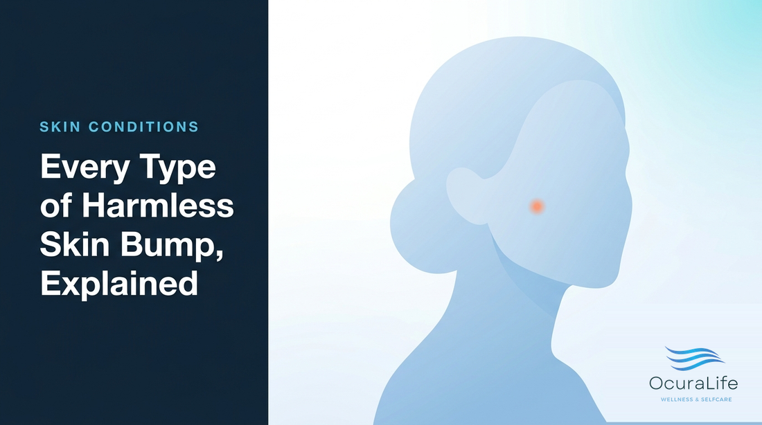 Every Type of Harmless Skin Bump, Explained