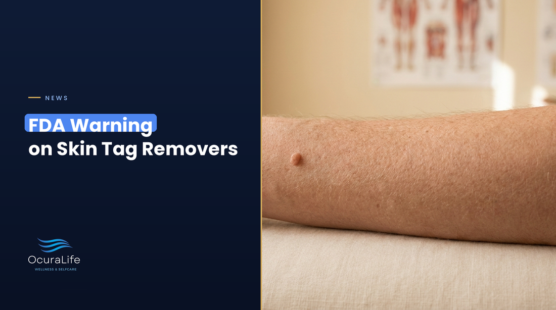 What the FDA's Warning on At-Home Mole and Skin Tag Removers Means for You