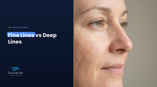 Fine lines at the outer eye corner and a deeper set crease on the cheek of a woman in her late 40s