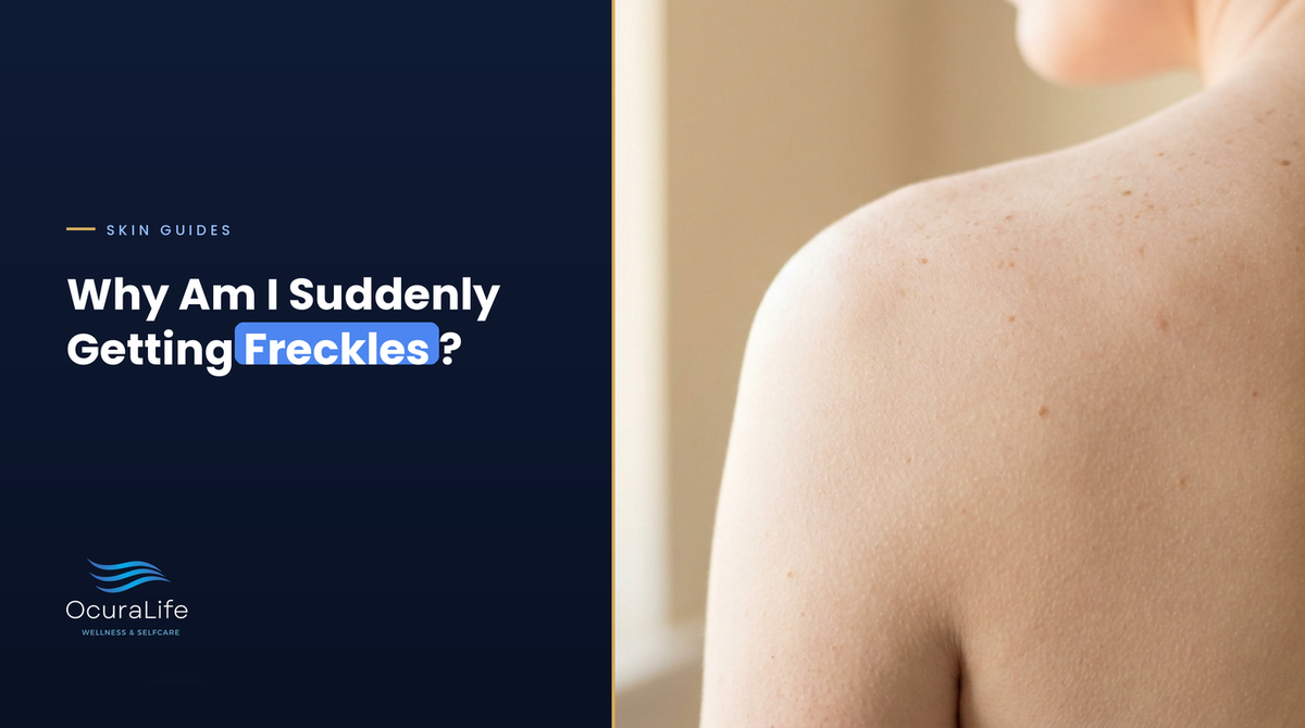 Why Am I Suddenly Getting Freckles?