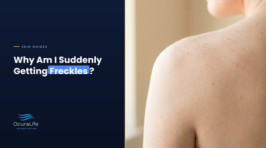 Why Am I Suddenly Getting Freckles?
