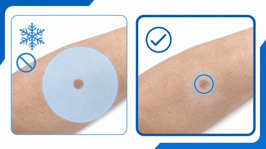 Using Wart Freeze Kits on Age Spots: The Real Risk infographic