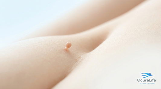 Skin Tags in the Groin and Inner Thighs: Safe Removal