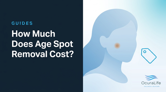 How Much Does Age Spot Removal Cost?
