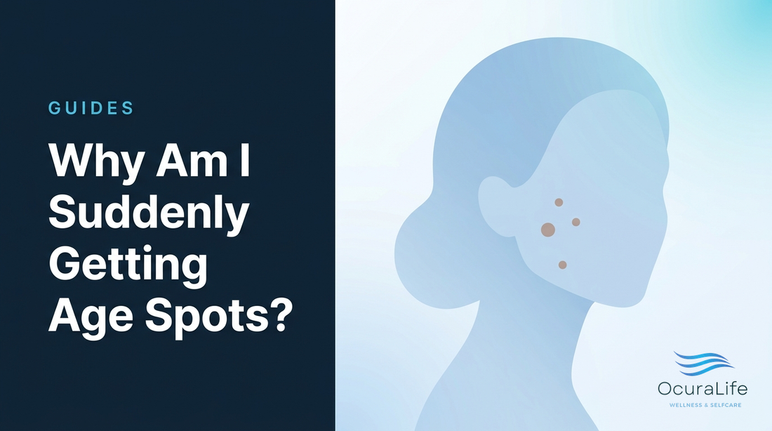 Why Am I Suddenly Getting Age Spots?