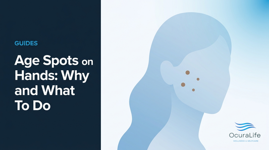 Age Spots on the Hands: Why and What To Do