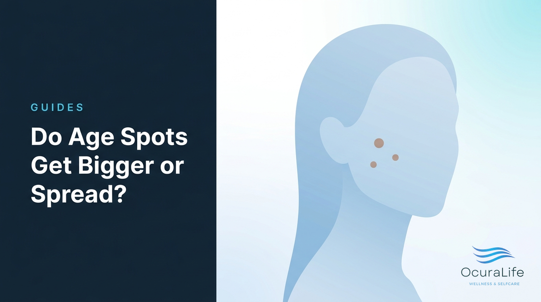 Do Age Spots Get Bigger or Spread?