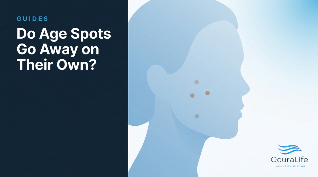 Editorial illustration: Do Age Spots Go Away on Their Own?