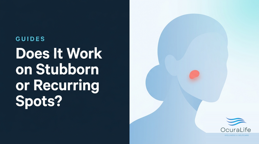 Does It Work on Stubborn or Recurring Spots?