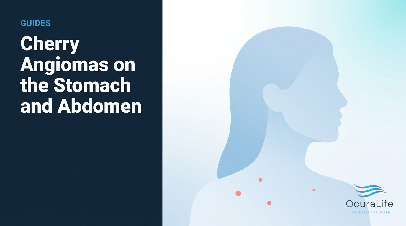 Editorial illustration: Cherry Angiomas on the Stomach and Abdomen