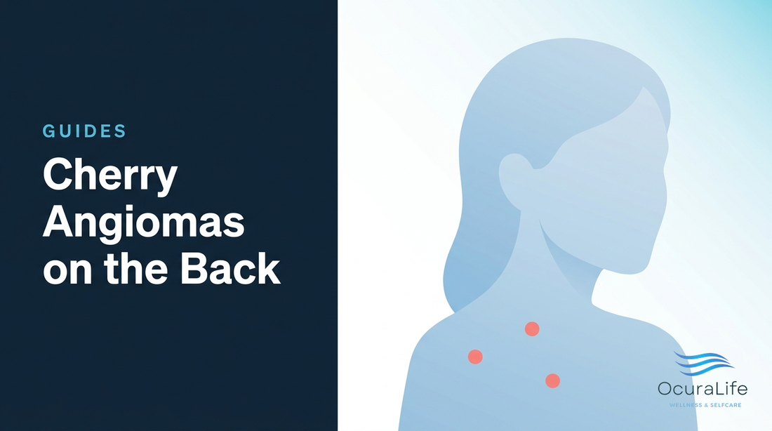 Editorial illustration: Cherry Angiomas on the Back