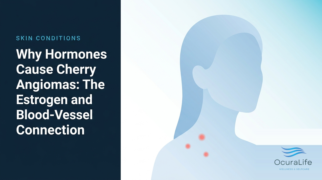 Cherry angiomas and hormones: the estrogen and blood-vessel connection
