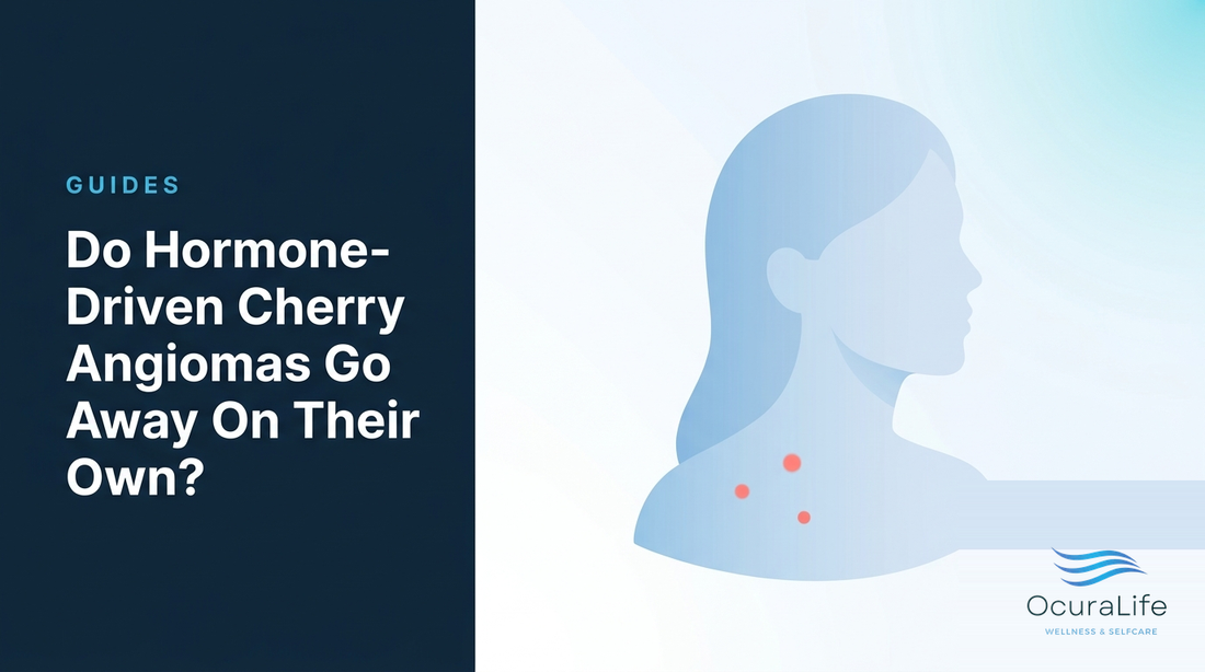 Do Hormone-Driven Cherry Angiomas Go Away On Their Own?