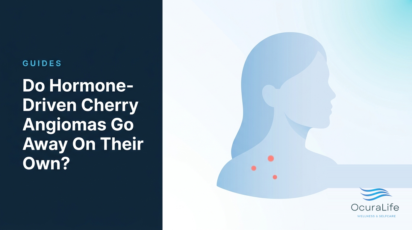 Do Hormone-Driven Cherry Angiomas Go Away On Their Own?