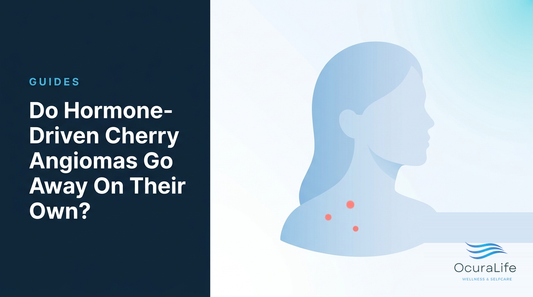 Do Hormone-Driven Cherry Angiomas Go Away On Their Own?