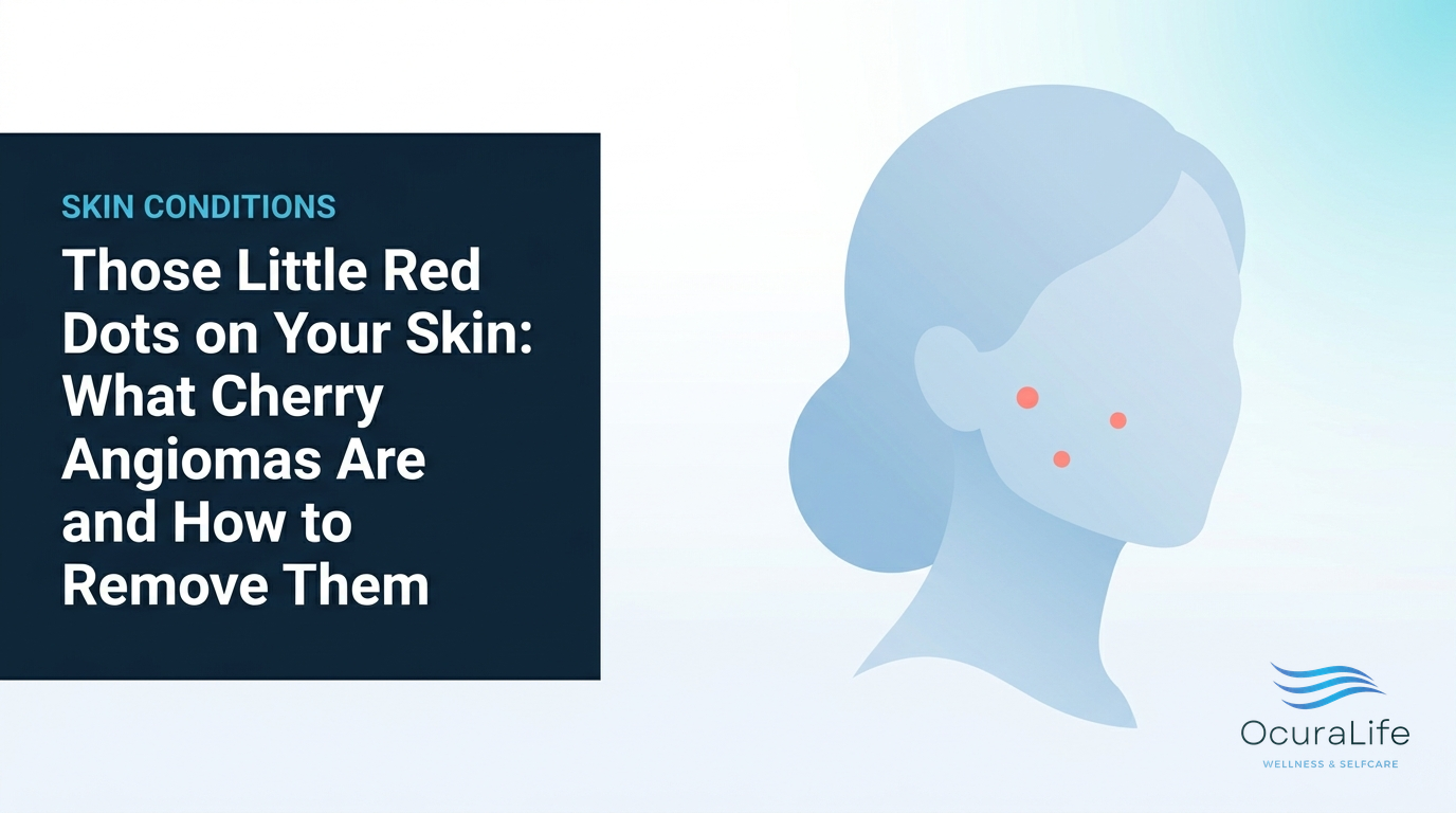 Those Little Red Dots on Your Skin: What Cherry Angiomas Are and How to Remove Them