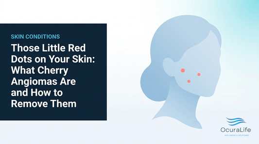 Those Little Red Dots on Your Skin: What Cherry Angiomas Are and How to Remove Them