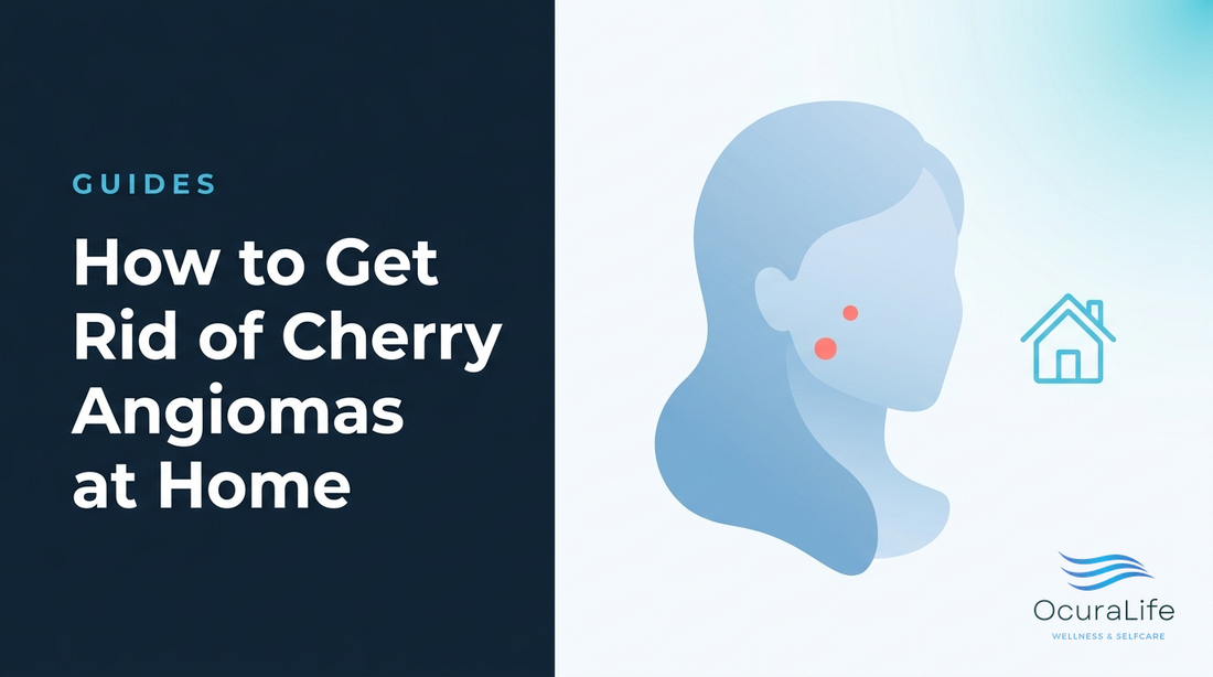 How to Get Rid of Cherry Angiomas at Home