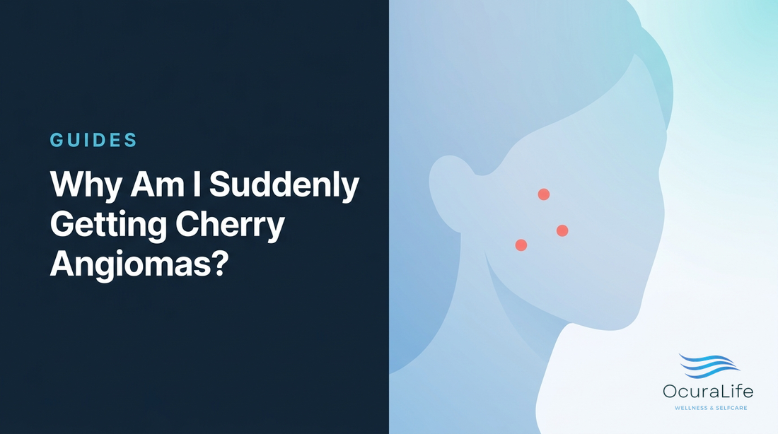 Why Am I Suddenly Getting Cherry Angiomas?