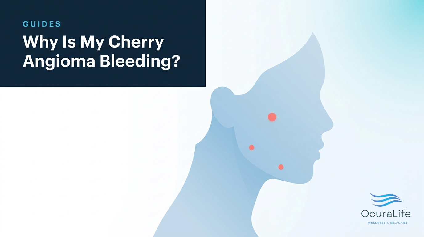 Why Is My Cherry Angioma Bleeding?