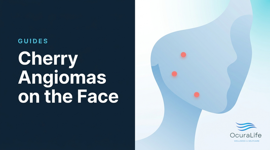 Cherry Angiomas on the Face