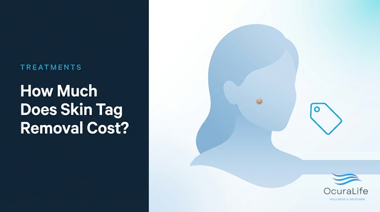 How Much Does Skin Tag Removal Cost?