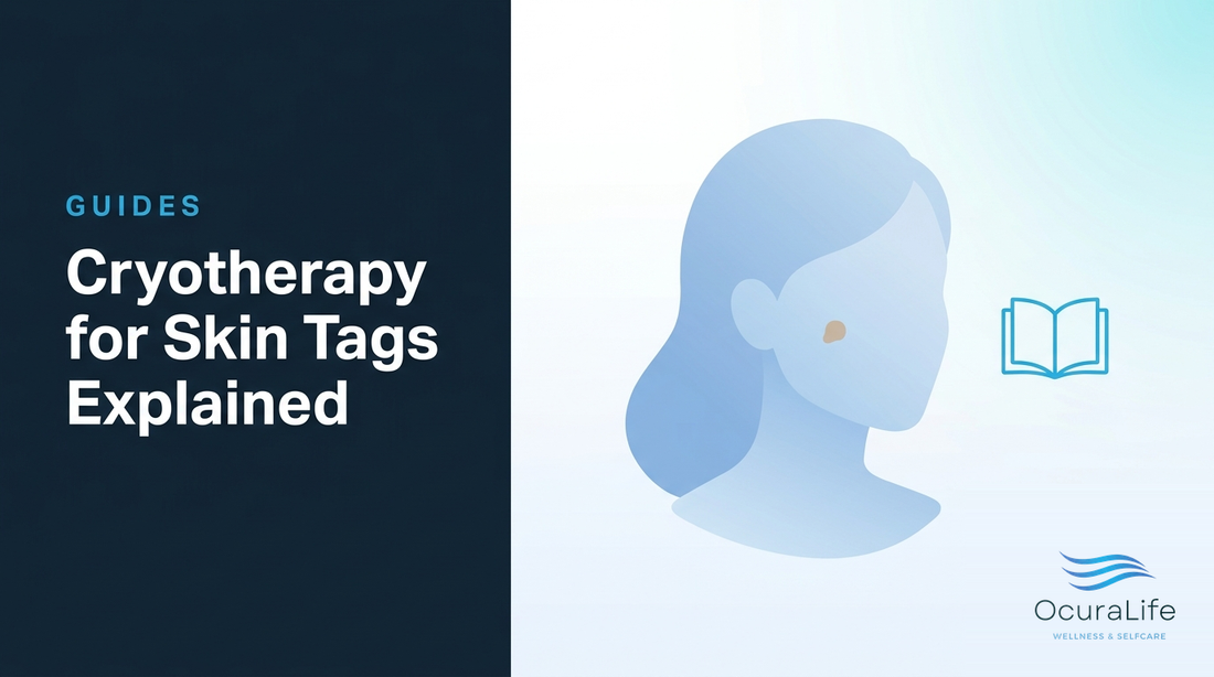 Cryotherapy for Skin Tags Explained