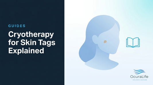 Cryotherapy for Skin Tags Explained