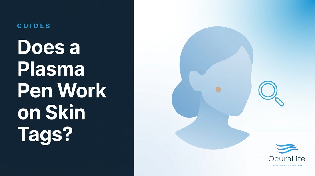 Does a Plasma Pen Work on Skin Tags?