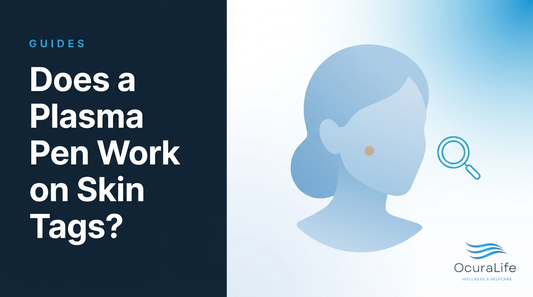 Does a Plasma Pen Work on Skin Tags?