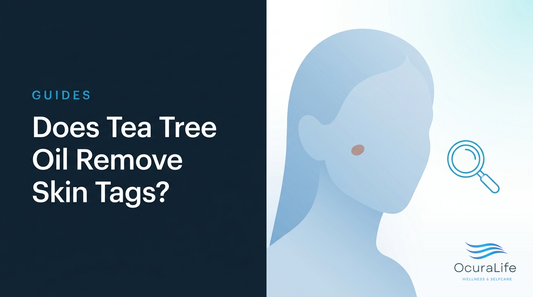Does Tea Tree Oil Remove Skin Tags?