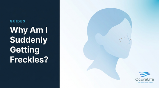 Editorial illustration: Why Am I Suddenly Getting Freckles?